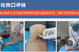 创面治疗
